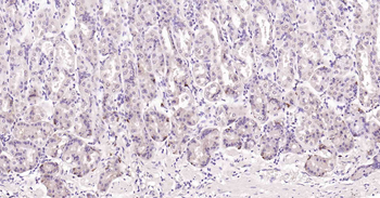 Beclin 1 Recombinant Rabbit Monoclonal Antibody