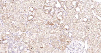 Beclin 1 Recombinant Rabbit Monoclonal Antibody