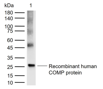 COMP Rabbit Polyclonal Antibody