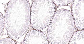 CD34 Recombinant Rabbit Monoclonal Antibody