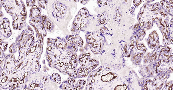 CD34 Recombinant Rabbit Monoclonal Antibody