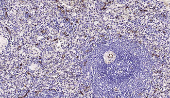 CD34 Recombinant Rabbit Monoclonal Antibody