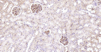 CD34 Recombinant Rabbit Monoclonal Antibody