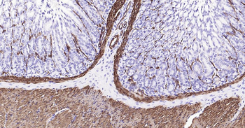 CNN1 Recombinant Rabbit Monoclonal Antibody