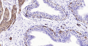 CNN1 Recombinant Rabbit Monoclonal Antibody