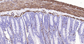 CNN1 Recombinant Rabbit Monoclonal Antibody