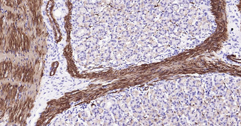 CNN1 Recombinant Rabbit Monoclonal Antibody