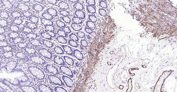 CNN1 Recombinant Rabbit Monoclonal Antibody