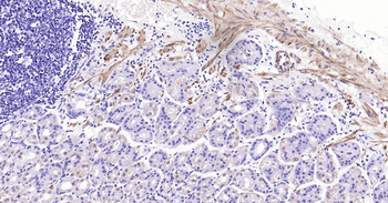 CNN1 Recombinant Rabbit Monoclonal Antibody