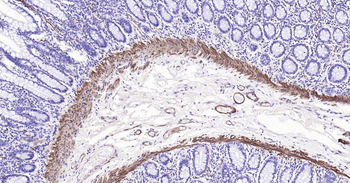CNN1 Recombinant Rabbit Monoclonal Antibody