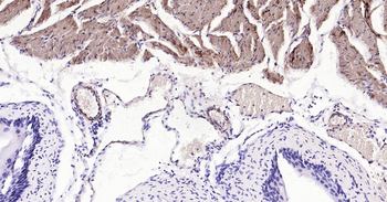 CNN1 Recombinant Rabbit Monoclonal Antibody