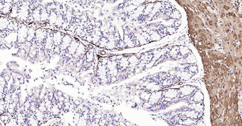 CNN1 Recombinant Rabbit Monoclonal Antibody