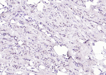 Progesterone Receptor Recombinant Rabbit Monoclonal Antibody