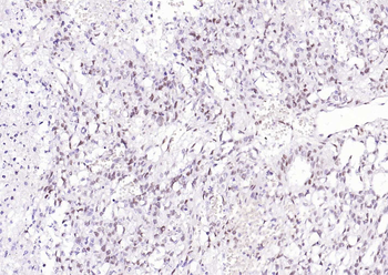 Progesterone Receptor Recombinant Rabbit Monoclonal Antibody