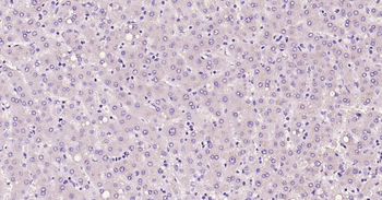 AFP Recombinant Rabbit Monoclonal Antibody