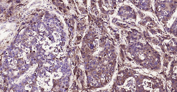 AFP Recombinant Rabbit Monoclonal Antibody