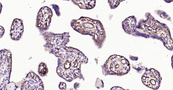 AFP Recombinant Rabbit Monoclonal Antibody