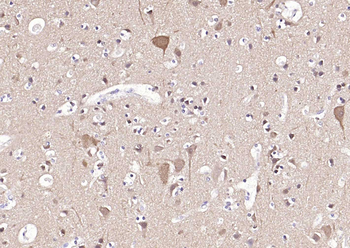 PGP9.5 Mouse Monoclonal Antibody