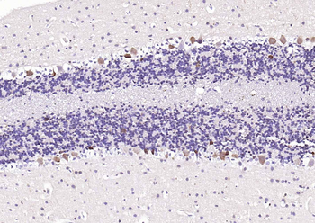 PGP9.5 Mouse Monoclonal Antibody