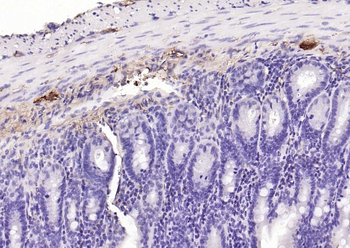 PGP9.5 Mouse Monoclonal Antibody