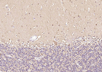 PGP9.5 Mouse Monoclonal Antibody