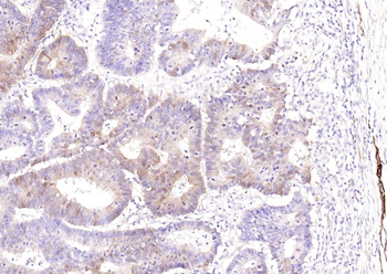 PGP9.5 Mouse Monoclonal Antibody