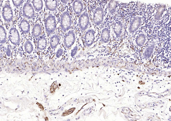 PGP9.5 Mouse Monoclonal Antibody
