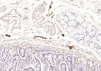 PGP9.5 Mouse Monoclonal Antibody