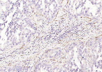 PGP9.5 Mouse Monoclonal Antibody