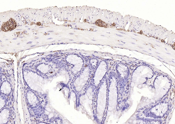 PGP9.5 Mouse Monoclonal Antibody