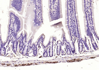 PGP9.5 Mouse Monoclonal Antibody
