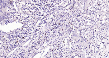 Granzyme B Recombinant Rabbit Monoclonal Antibody