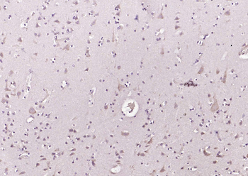 CRTC1 Rabbit Polyclonal Antibody