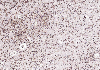 CRTC1 Rabbit Polyclonal Antibody