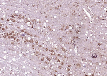 CRTC1 Rabbit Polyclonal Antibody