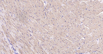 DDIT3 Recombinant Rabbit Monoclonal Antibody