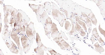 DDIT3 Recombinant Rabbit Monoclonal Antibody