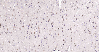 DDIT3 Recombinant Rabbit Monoclonal Antibody