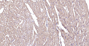 DDIT3 Recombinant Rabbit Monoclonal Antibody