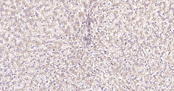DDIT3 Recombinant Rabbit Monoclonal Antibody