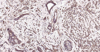 DDIT3 Recombinant Rabbit Monoclonal Antibody