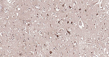 DDIT3 Recombinant Rabbit Monoclonal Antibody