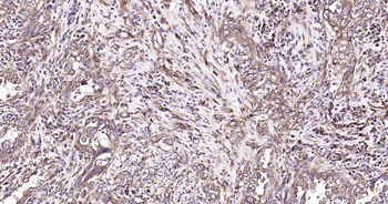 DDIT3 Recombinant Rabbit Monoclonal Antibody