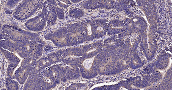 DDIT3 Recombinant Rabbit Monoclonal Antibody