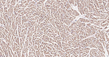DDIT3 Recombinant Rabbit Monoclonal Antibody