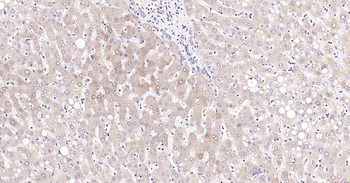 DDIT3 Recombinant Rabbit Monoclonal Antibody