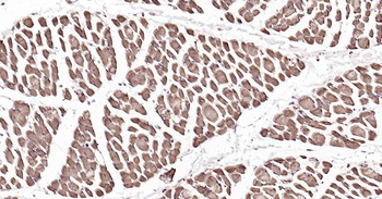 DDIT3 Recombinant Rabbit Monoclonal Antibody