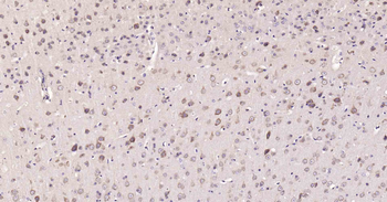 DDIT3 Recombinant Rabbit Monoclonal Antibody