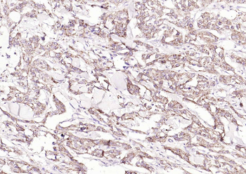 SPARC Rabbit Polyclonal Antibody