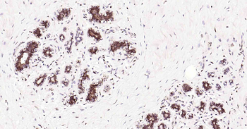 Tau Recombinant Rabbit Monoclonal Antibody